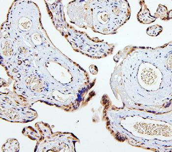 SMAD2 Rabbit Polyclonal Antibody