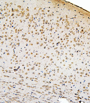 SMAD2 Rabbit Polyclonal Antibody