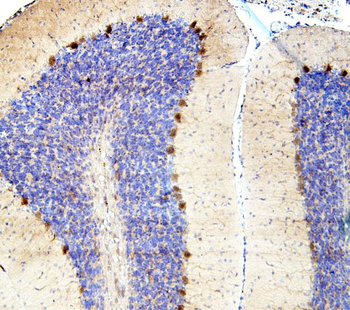 SMAD2 Rabbit Polyclonal Antibody