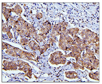 CDC42 Rabbit Polyclonal Antibody