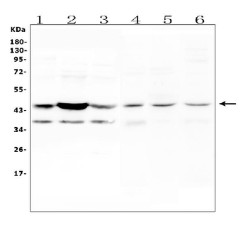 CCR2 Rabbit Polyclonal Antibody