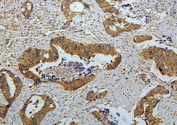 RET Rabbit Polyclonal Antibody