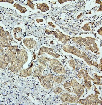 RET Rabbit Polyclonal Antibody