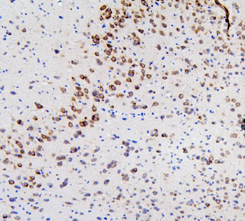 RET Rabbit Polyclonal Antibody