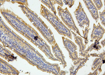 RET Rabbit Polyclonal Antibody