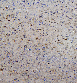 RET Rabbit Polyclonal Antibody