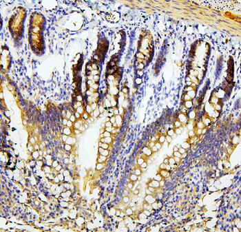 RET Rabbit Polyclonal Antibody