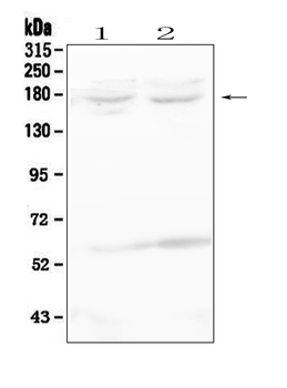 RET Rabbit Polyclonal Antibody