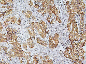 CDK5 Rabbit Polyclonal Antibody
