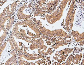 CDK5 Rabbit Polyclonal Antibody