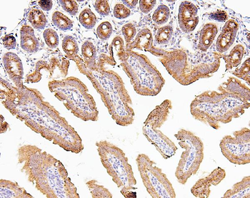 CDK5 Rabbit Polyclonal Antibody