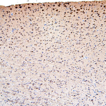 CDK5 Rabbit Polyclonal Antibody