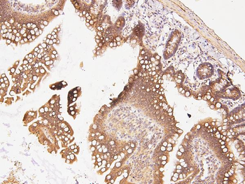 CDK5 Rabbit Polyclonal Antibody