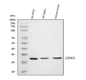 CDK5 Rabbit Polyclonal Antibody