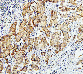 Zinc finger protein GLI2 GLI2 Antibody