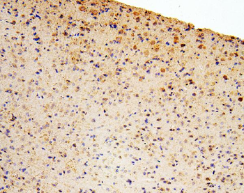 Zinc finger protein GLI2 GLI2 Antibody