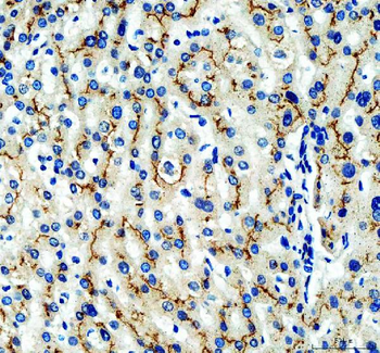 MRP2/ABCC2 Rabbit Polyclonal Antibody