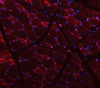 Caveolin-3/CAV3 Rabbit Polyclonal Antibody
