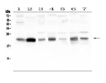 Caveolin-3/CAV3 Rabbit Polyclonal Antibody