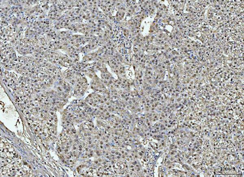 liver Arginase/ARG1 Rabbit Polyclonal Antibody