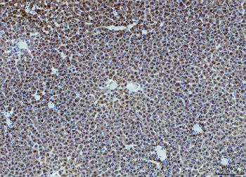 liver Arginase/ARG1 Rabbit Polyclonal Antibody
