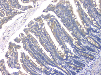 HDAC5 Rabbit Polyclonal Antibody