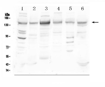 HDAC5 Rabbit Polyclonal Antibody