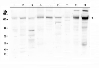 HDAC5 Rabbit Polyclonal Antibody