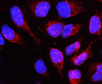 Lamin B Receptor/LBR Antibody