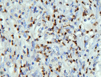 Lamin B Receptor/LBR Antibody