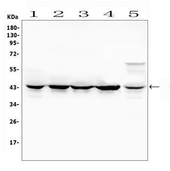 MEK4/MAP2K4 Rabbit Polyclonal Antibody
