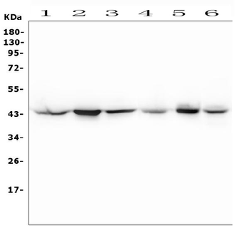MEK4/MAP2K4 Rabbit Polyclonal Antibody