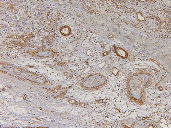 EHD1 Rabbit Polyclonal Antibody