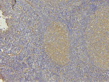 EHD1 Rabbit Polyclonal Antibody