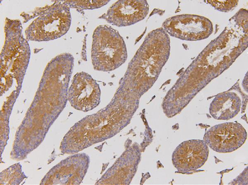 EHD1 Rabbit Polyclonal Antibody