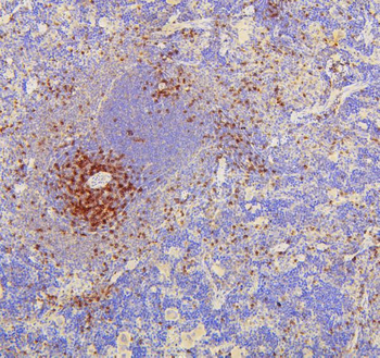 CD8 alpha/Cd8a Rabbit Polyclonal Antibody