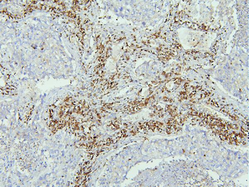 EBP50/NHERF-1/SLC9A3R1 Antibody