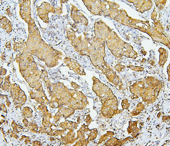 EBP50/NHERF-1/SLC9A3R1 Antibody