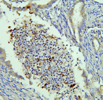NRAMP1/SLC11A1 Rabbit Polyclonal Antibody
