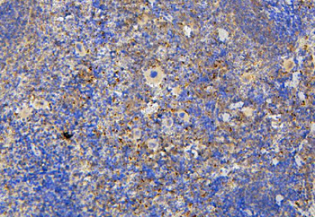 NRAMP1/SLC11A1 Rabbit Polyclonal Antibody