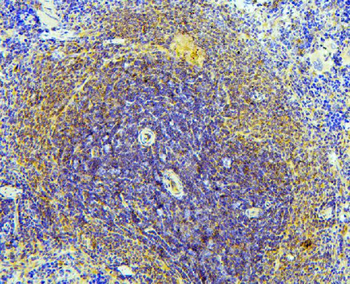 NRAMP1/SLC11A1 Rabbit Polyclonal Antibody