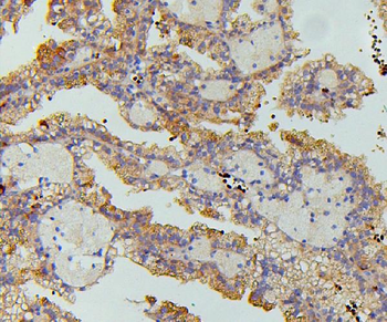 SGLT2/SLC5A2 Antibody