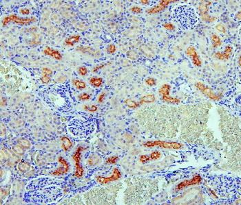 SGLT2/SLC5A2 Antibody