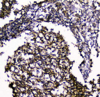 SIRT4 Rabbit Polyclonal Antibody