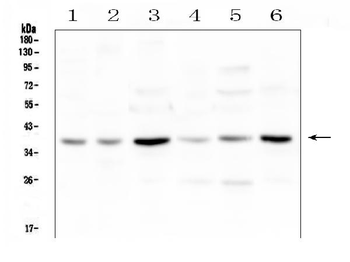 SIRT4 Rabbit Polyclonal Antibody