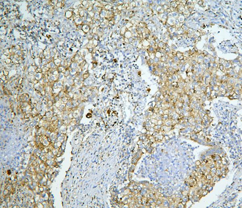 LONP1/Lon Rabbit Polyclonal Antibody