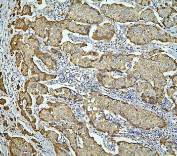 LONP1/Lon Rabbit Polyclonal Antibody