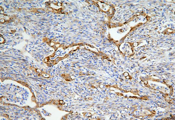 LONP1/Lon Rabbit Polyclonal Antibody