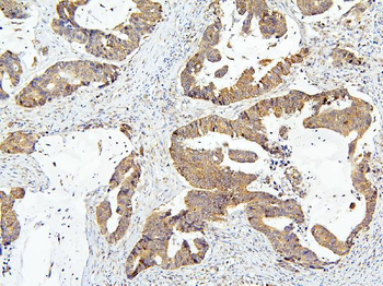 OLFM4 Rabbit Polyclonal Antibody