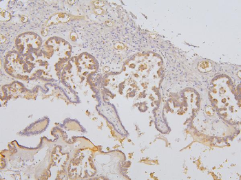 KCC2/SLC12A5 Rabbit Polyclonal Antibody